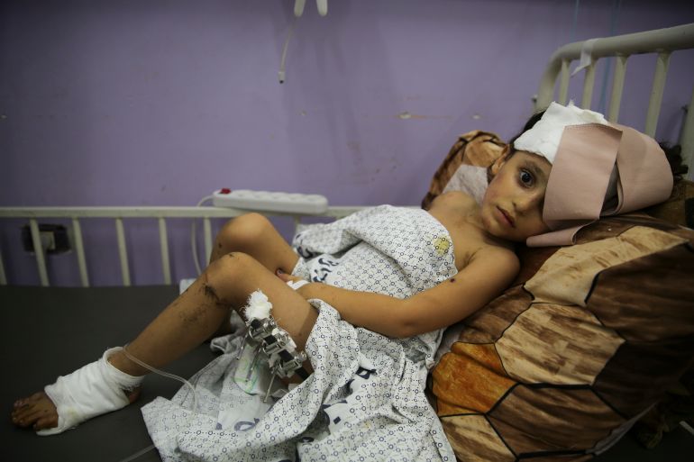 Kenzi al Madhoun, a four-year-old who was wounded in Israeli bombardment, lies at Al Aqsa Hospital